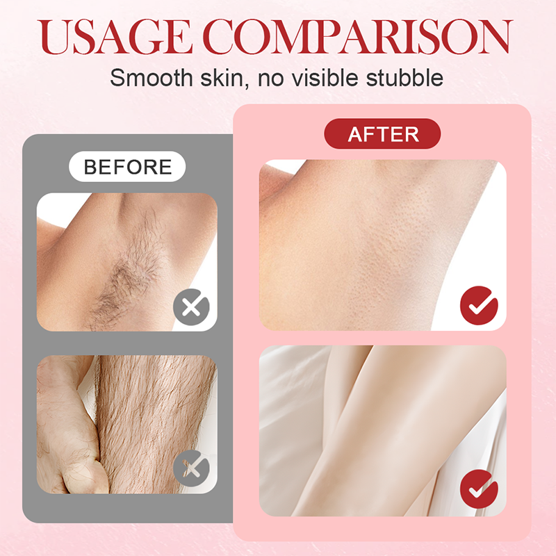👑 Tragbarer elektrischer Epilator mit Doppelkopf ✨⚡